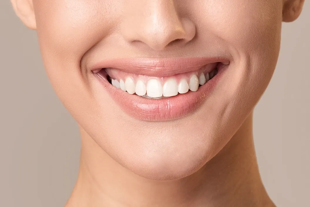 Professional Zoom teeth-whitening treatment