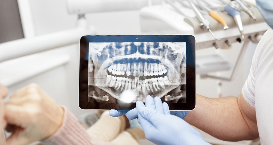 Dental cleaning and digital X-rays