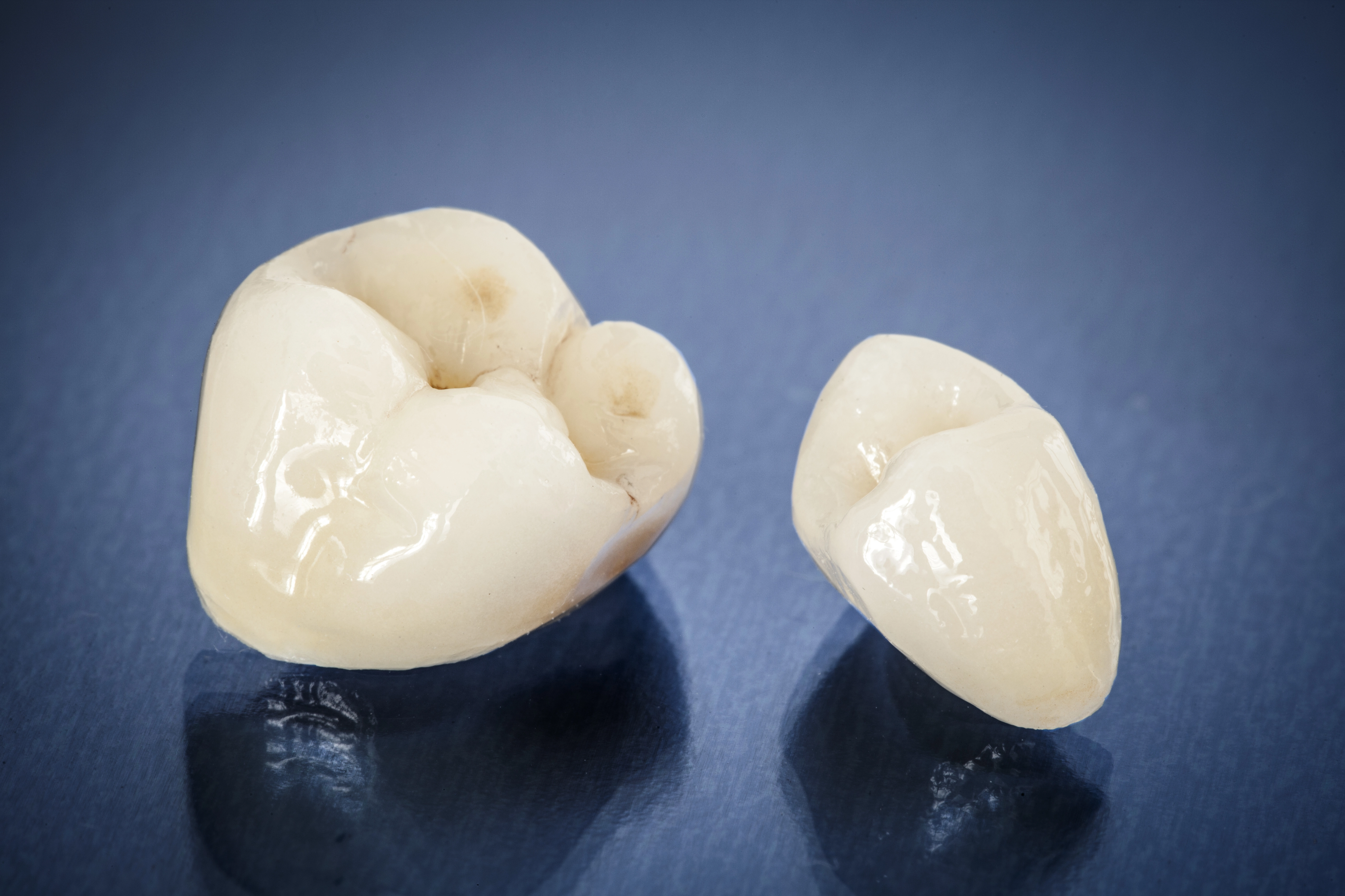 Natural-looking smile restored with a dental crown