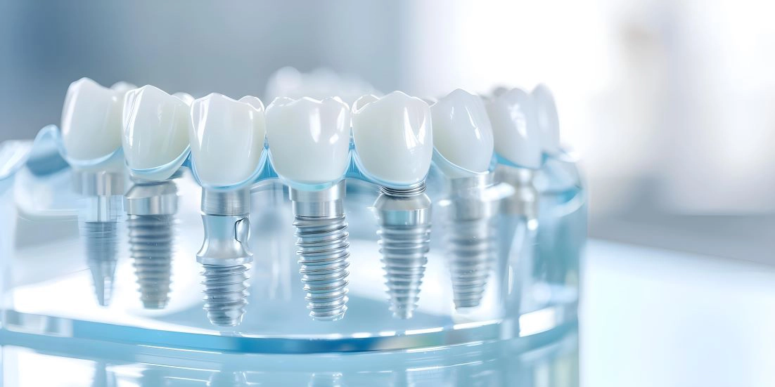 Dental implant restoration in Manchester, New Hampshire