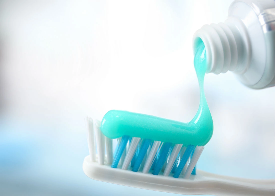 Professional fluoride treatment for cavity prevention