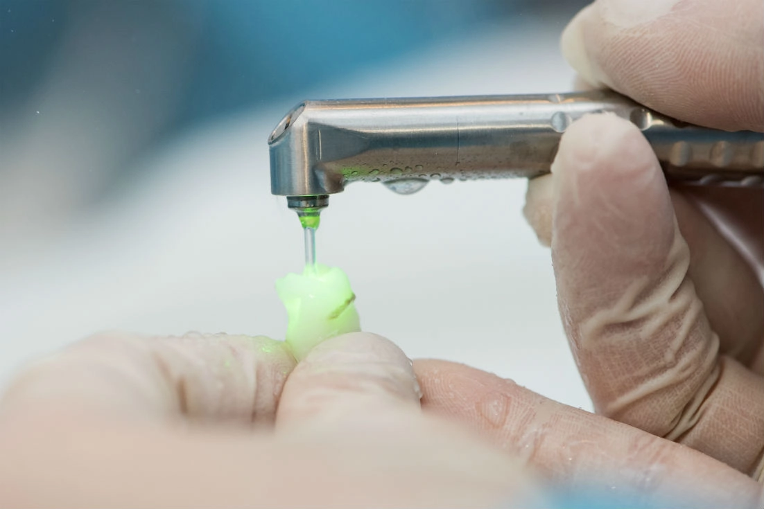 Laser dentistry treatment in Manchester, New Hampshire