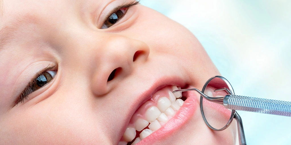 Protective dental sealant applied to a tooth