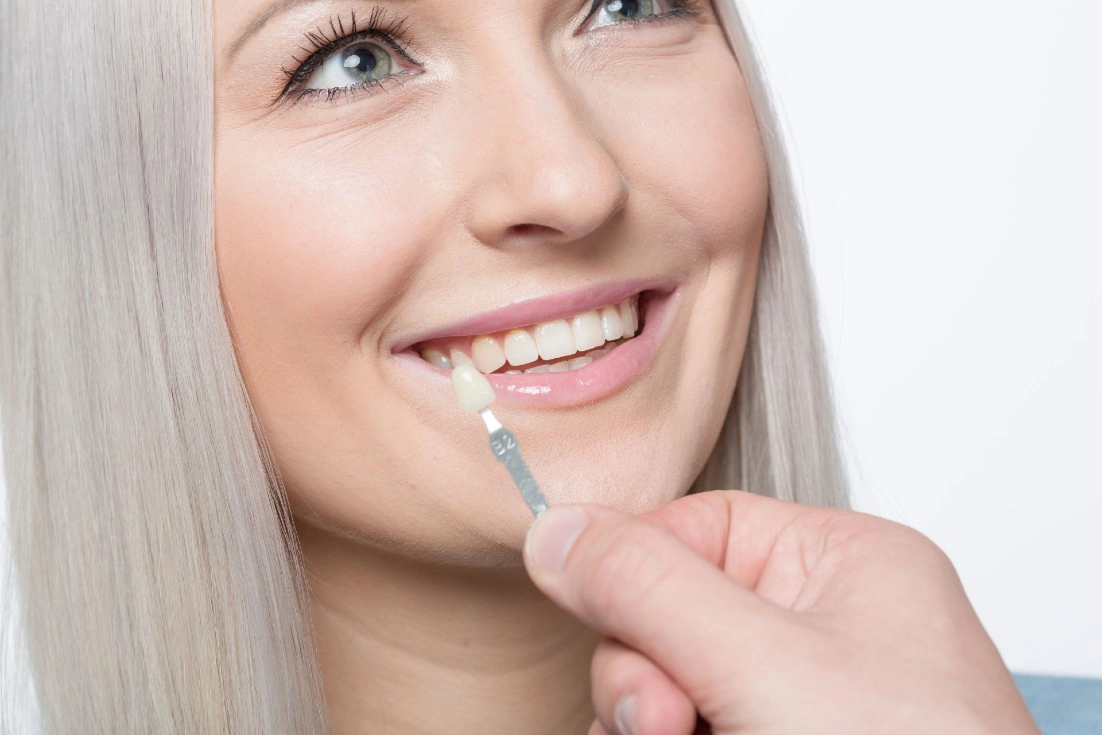 Natural-looking porcelain veneers in Manchester